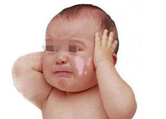 孩子得了白癜风会受到什么伤害