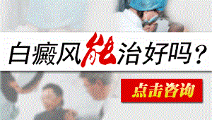 寻常型白癜风能不能治好